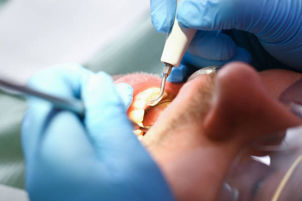 Best Dentist for Dental Trauma  in Spurgeon, TN